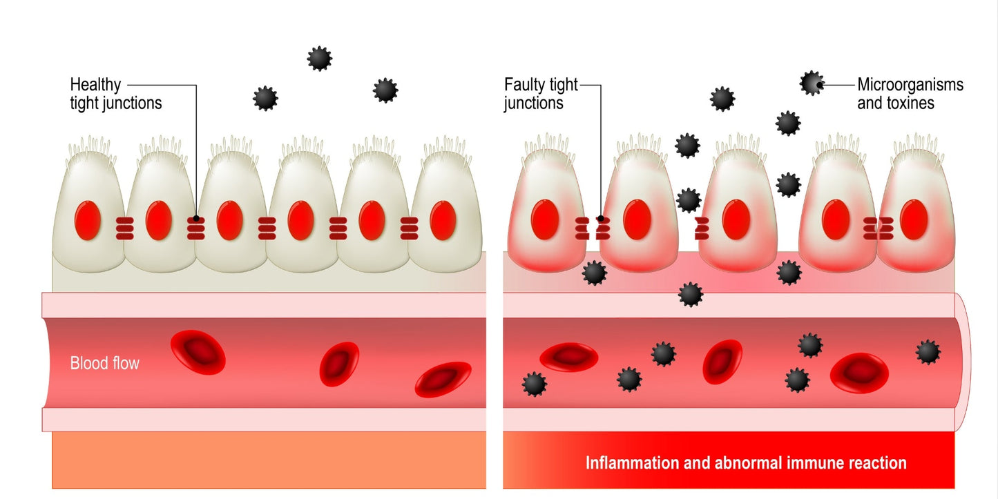 Is Your Gut Leaking? Understanding Intestinal Permeability and How to Fix It